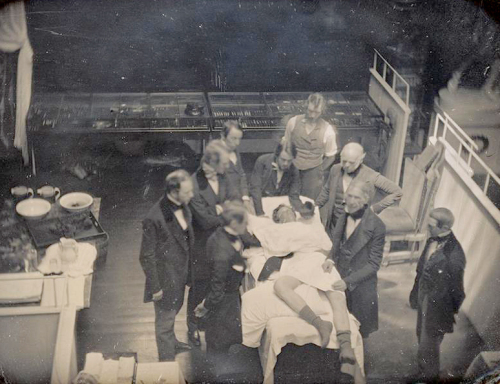 Early operation using ether for anesthesia, late spring 1847