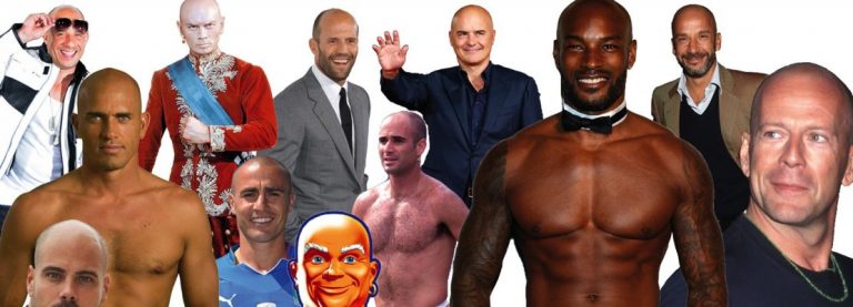 LA CALVIZIE SI SCONFIGGE AGENDO SUBITO