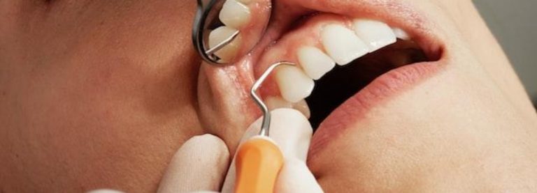 5 CONSIGLI PER L’IGIENE ORALE